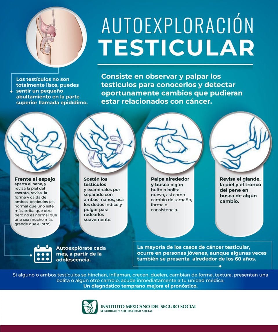 INVITAN A LOS VARONES A PREVENIR EL CÁNCER DE PRÓSTATA