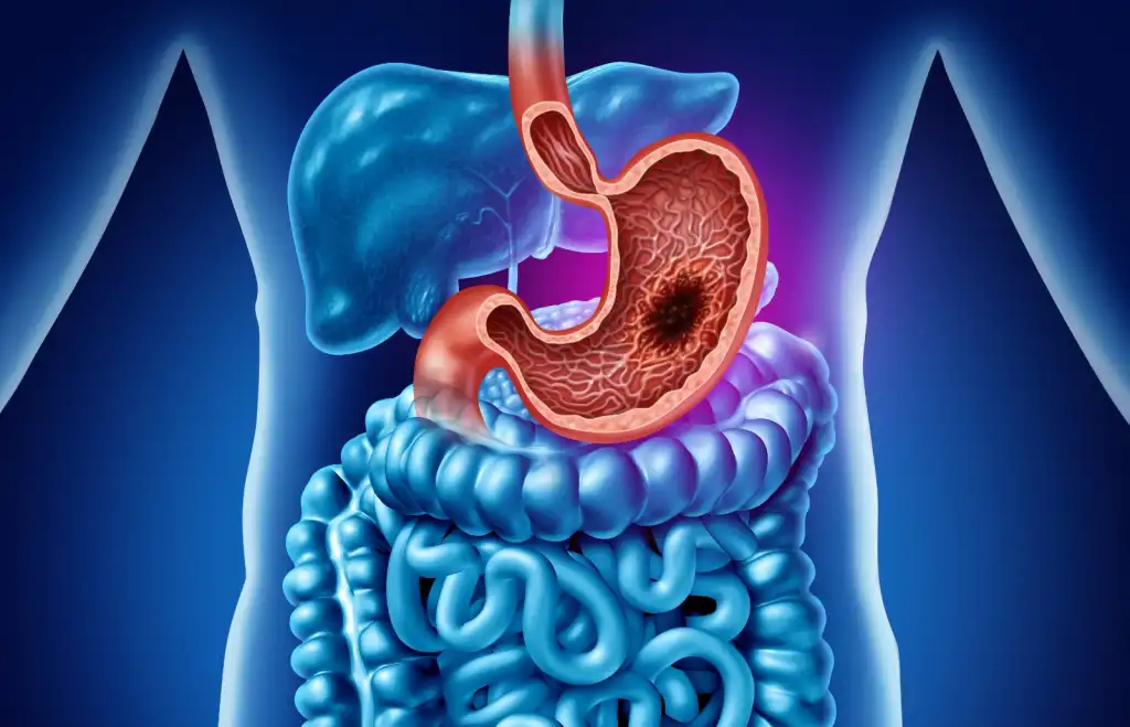 EXHORTAN A CUIDAR CONSUMO DE ALIMENTOS PARA EVITAR ENFERMEDADES GASTROINTESTINALES
